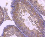 ZNRF2 Recombinant Rabbit Monoclonal Antibody (JJ0924)