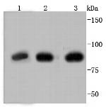 Glucocorticoid Receptor Recombinant Rabbit Monoclonal Antibody (JF0952)