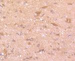 TPA Antibody in Immunohistochemistry (Paraffin) (IHC (P))