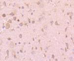 TPA Recombinant Rabbit Monoclonal Antibody (JF0958)