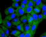 ACSS2 Antibody in Immunocytochemistry (ICC/IF)