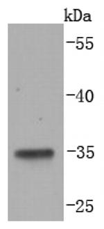LYVE1 Recombinant Rabbit Monoclonal Antibody (JF0979)