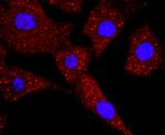 TK1 Recombinant Rabbit Monoclonal Antibody (JF0970)