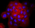 gamma Catenin Antibody in Immunocytochemistry (ICC/IF)
