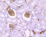 S100A10 Antibody in Immunohistochemistry (Paraffin) (IHC (P))