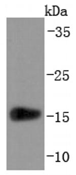 Transthyretin Antibody in Western Blot (WB)