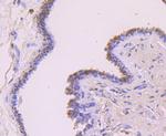 FOXP1 Recombinant Rabbit Monoclonal Antibody (JF1017)