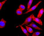 HLA-AB Recombinant Rabbit Monoclonal Antibody (JF10-38)