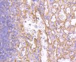 HLA-AB Antibody in Immunohistochemistry (Paraffin) (IHC (P))