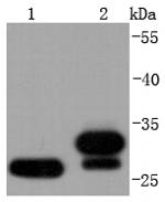 NQO1 Recombinant Rabbit Monoclonal Antibody (JF440-1)