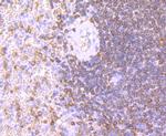 CD74 Antibody in Immunohistochemistry (Paraffin) (IHC (P))