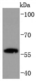 PPAR gamma Recombinant Rabbit Monoclonal Antibody (JF101-4)