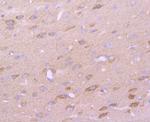 CD147 Antibody in Immunohistochemistry (Paraffin) (IHC (P))