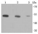 beta Tubulin Recombinant Rabbit Monoclonal Antibody (JF41-50), HRP