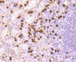 S100A9 Antibody in Immunohistochemistry (Paraffin) (IHC (P))