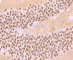 BCL11B Antibody in Immunohistochemistry (Paraffin) (IHC (P))