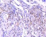 NEDD8 Antibody in Immunohistochemistry (Paraffin) (IHC (P))
