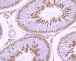 GLI1 Antibody in Immunohistochemistry (Paraffin) (IHC (P))