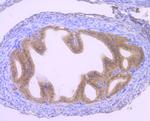 GLI1 Antibody in Immunohistochemistry (Paraffin) (IHC (P))