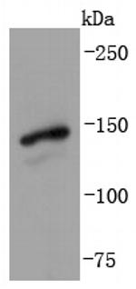 GLI1 Antibody in Western Blot (WB)