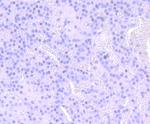 NUMB Antibody in Immunohistochemistry (Paraffin) (IHC (P))