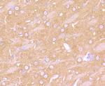 beta-2 Adrenergic Receptor Recombinant Rabbit Monoclonal Antibody (JM102-06)