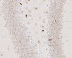 ADAM17 Antibody in Immunohistochemistry (Paraffin) (IHC (P))