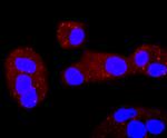 ERCC1 Recombinant Rabbit Monoclonal Antibody (JM10-07)