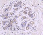 GBA Recombinant Rabbit Monoclonal Antibody (JM10-76)