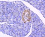 GBA Antibody in Immunohistochemistry (Paraffin) (IHC (P))