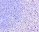 CD41 Recombinant Rabbit Monoclonal Antibody (JM11-19)