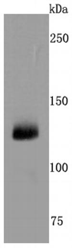CD41 Antibody in Western Blot (WB)