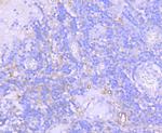 CD73 Antibody in Immunohistochemistry (Paraffin) (IHC (P))