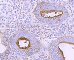 CD73 Antibody in Immunohistochemistry (Paraffin) (IHC (P))