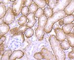Cathepsin H/K/L/V Recombinant Rabbit Monoclonal Antibody (JM10-78)