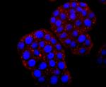 Hemoglobin gamma-1,2 Recombinant Rabbit Monoclonal Antibody (JM84-10)