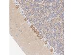 CaMKII alpha Recombinant Rabbit Monoclonal Antibody (JM11-07)