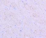 NEFM Antibody in Immunohistochemistry (Paraffin) (IHC (P))