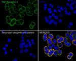 TNFR2 Antibody in Immunocytochemistry (ICC/IF)