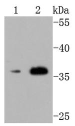 CD154 (CD40 Ligand) Antibody in Western Blot (WB)