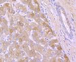 A2M Antibody in Immunohistochemistry (Paraffin) (IHC (P))