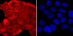 TDP-43 Antibody in Immunocytochemistry (ICC/IF)