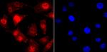TDP-43 Antibody in Immunocytochemistry (ICC/IF)
