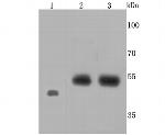 Endothelin B Receptor Recombinant Rabbit Monoclonal Antibody (JM74-10)