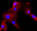 RAC1/RAC2/RAC3 Recombinant Rabbit Monoclonal Antibody (JM11-29)