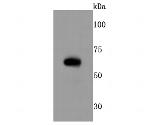 RPE65 Recombinant Rabbit Monoclonal Antibody (JM61-51)