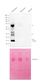Transthyretin Antibody in Western Blot (WB)