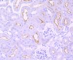 mGluR1 Recombinant Rabbit Monoclonal Antibody (JM11-61)