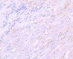 SGCD Recombinant Rabbit Monoclonal Antibody (JM61-10)