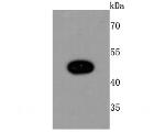 MYOD Recombinant Rabbit Monoclonal Antibody (JM10-72)